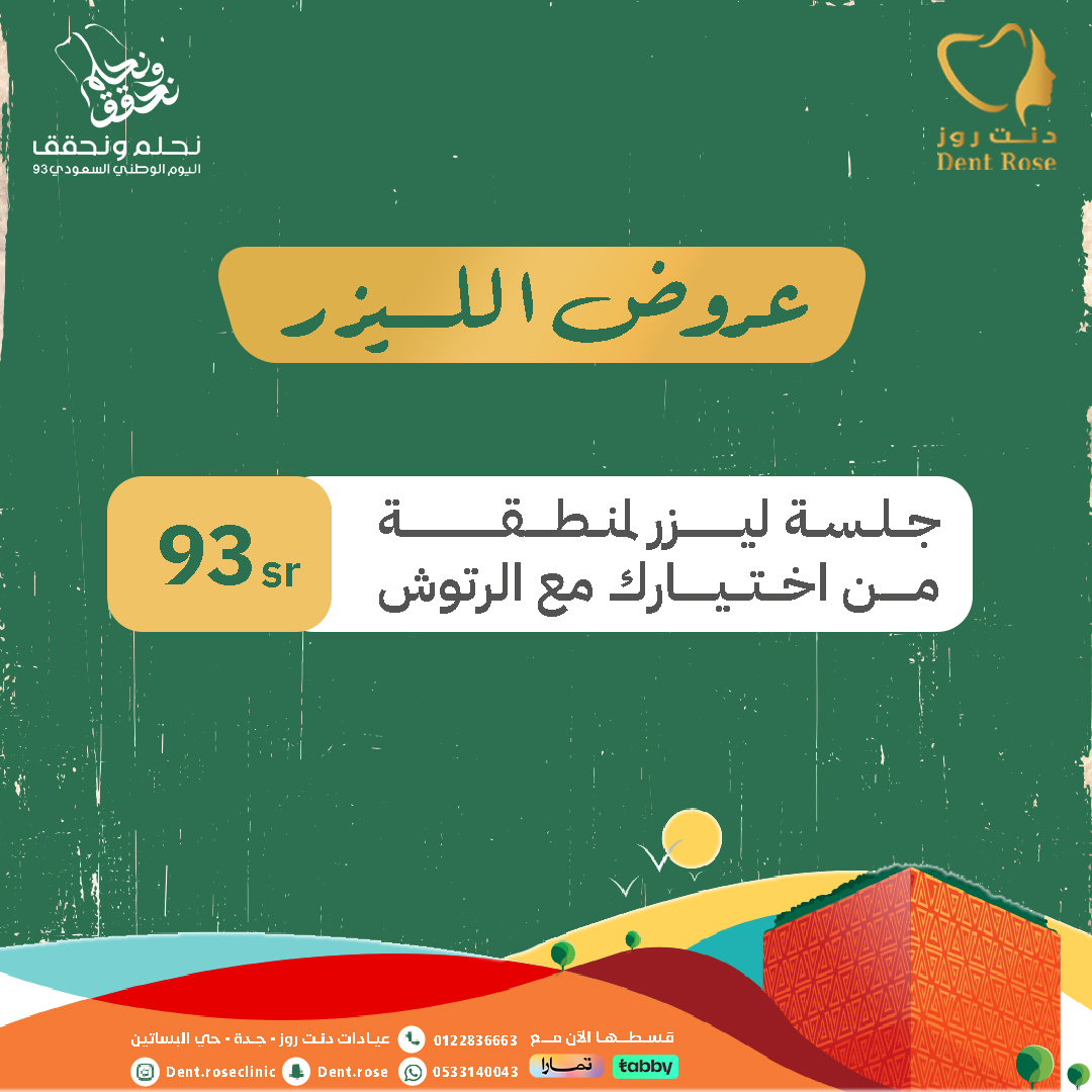 عروض الليزر