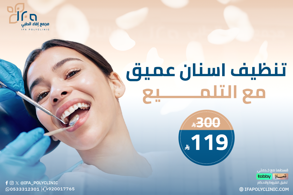 تنظيف اسنان عميق مع التلميع من مجمع ايفاء الطبي