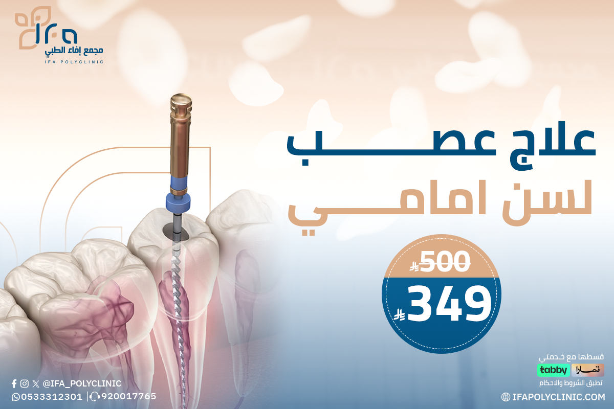 خدمة علاج عصب لسن امامي من مجمع إيفاء الطبي