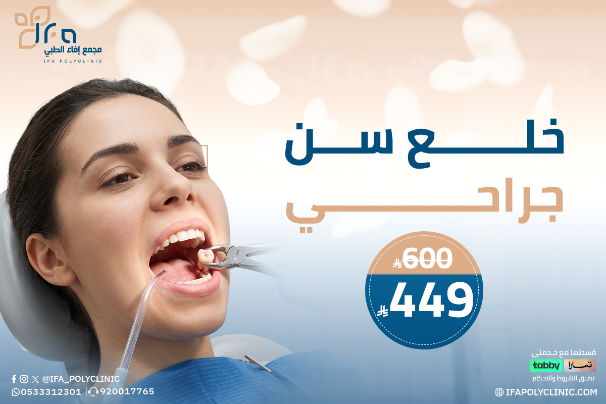 خدمة خلع سن جراحي من مجمع إيفاء الطبي